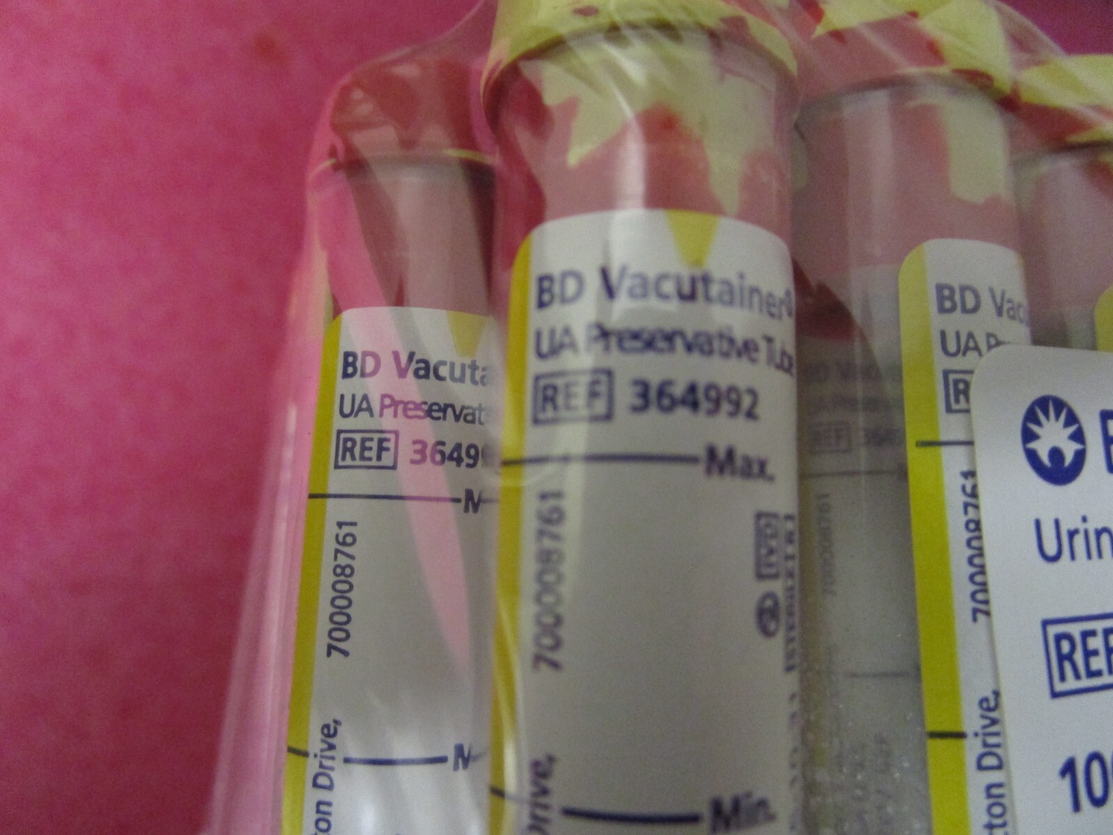BD Vacutainer REF 364992 8mL Urine Analysis Preservative Tube 100 Pack EX10/2025