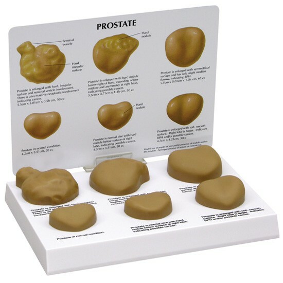 Prostate Gland Anatomical Model Set of Six GPI LFA #3000 SEE VIDEO