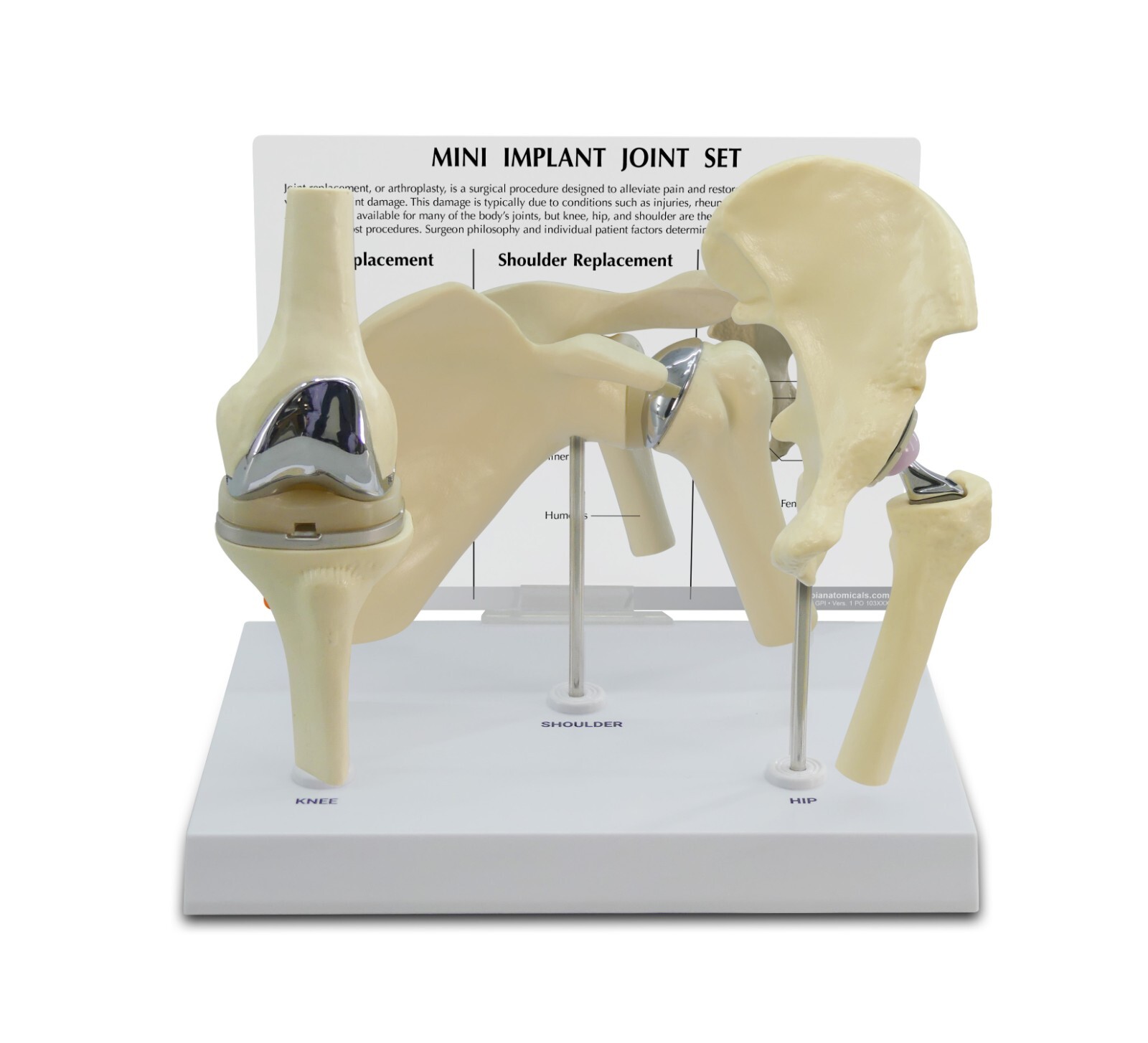 Implant Mini-Implant Joint Anatomical Model Set of 3 GPI LFA #1910