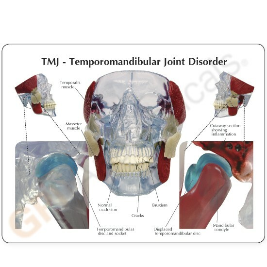 TMJ – Temporomandibular Joint Anatomical Model GPI LFA #2880 SEE VIDEO