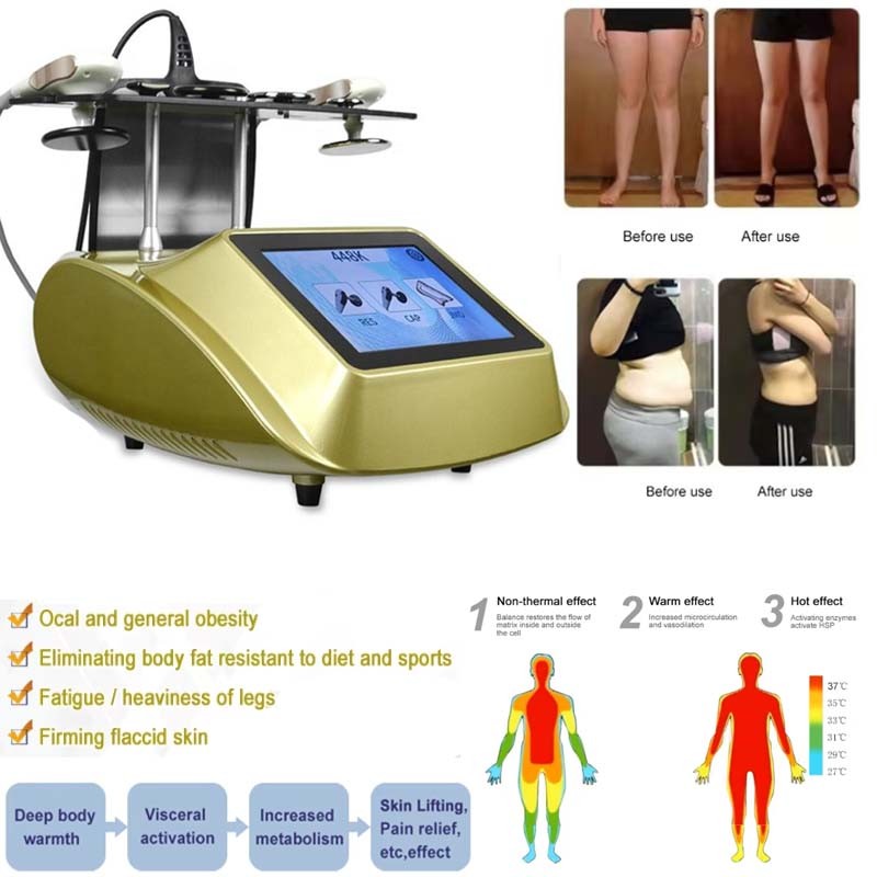 Monopolar RF Diathermy RET CET Face Lifting Fat Burning Pain Machine
