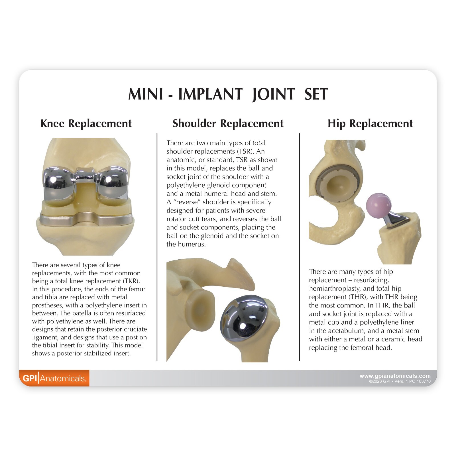 Implant Mini-Implant Joint Anatomical Model Set of 3 GPI LFA #1910
