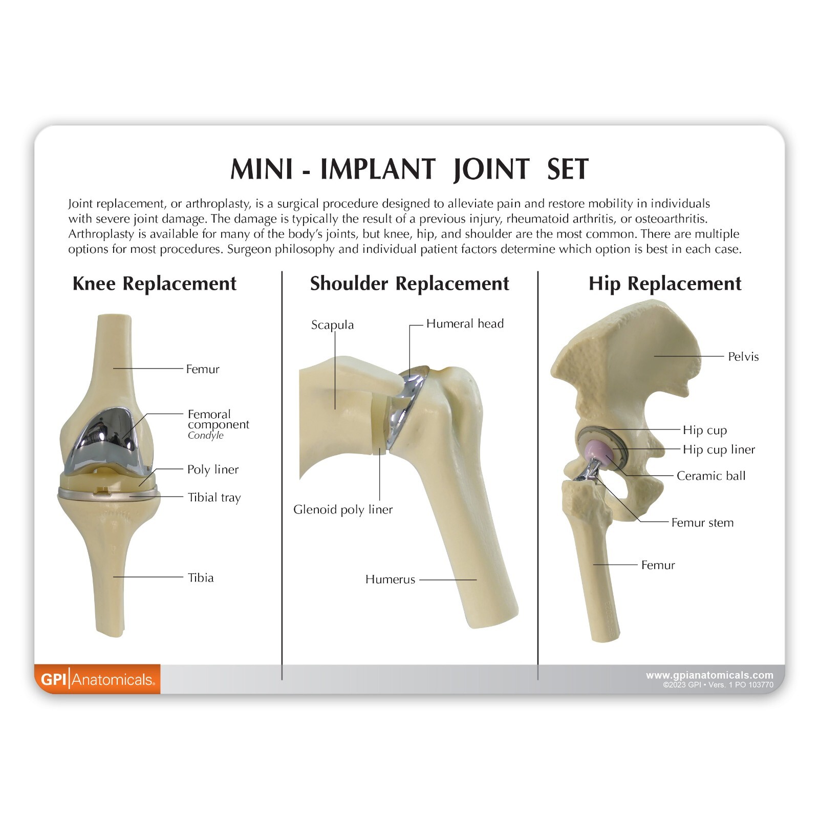 Implant Mini-Implant Joint Anatomical Model Set of 3 GPI LFA #1910