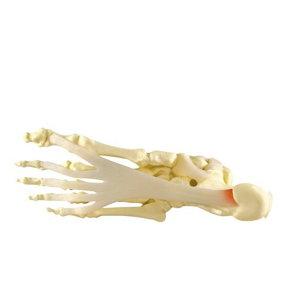 Foot Ankle w Plantar Fasciitis Anatomical Model GPI LFA #1980 SEE VIDEO