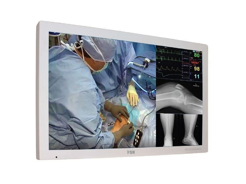 FSN FM-D5801DV 58-INCH 4K UHD SURGICAL LCD MONITOR